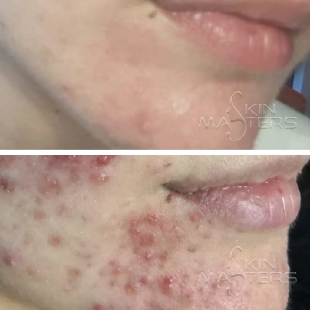 Skin Masters Aesthetics Center, Skin & Facials in Lusail – photo 2